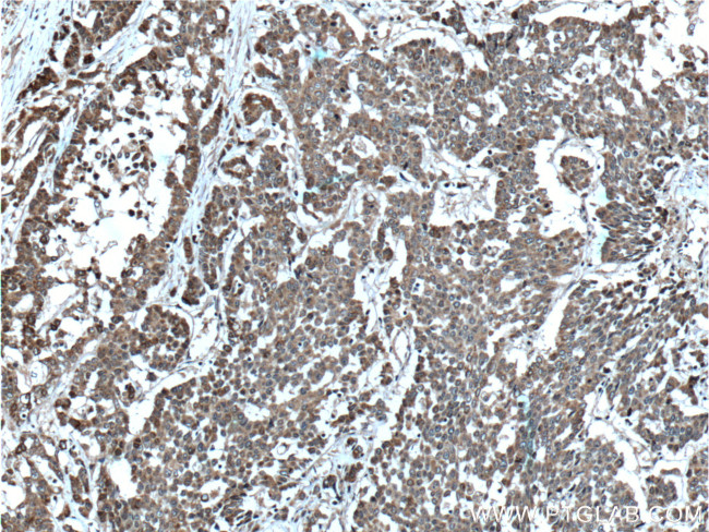 DALRD3 Antibody in Immunohistochemistry (Paraffin) (IHC (P))