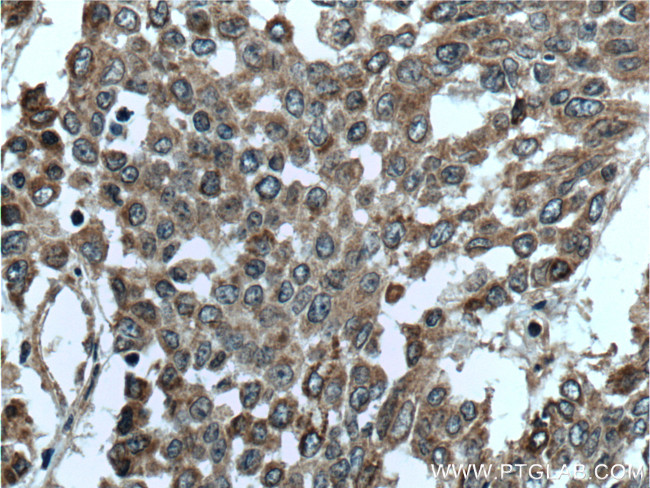 DALRD3 Antibody in Immunohistochemistry (Paraffin) (IHC (P))