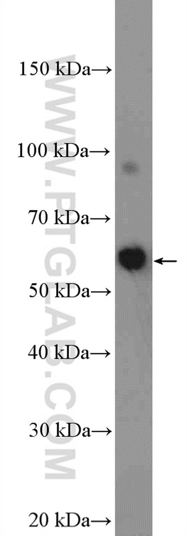 DALRD3 Antibody in Western Blot (WB)