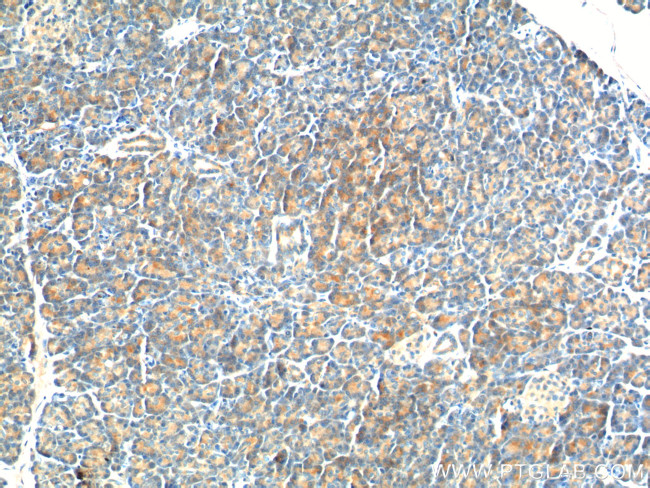 YRDC Antibody in Immunohistochemistry (Paraffin) (IHC (P))