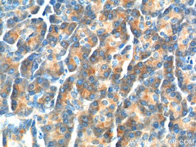 YRDC Antibody in Immunohistochemistry (Paraffin) (IHC (P))