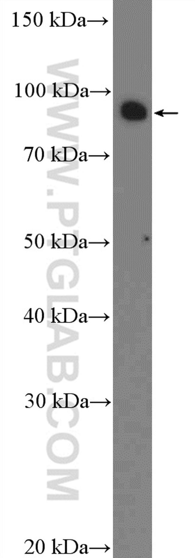 CCDC21 Antibody in Western Blot (WB)