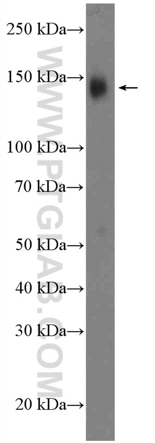 ZNF828 Antibody in Western Blot (WB)