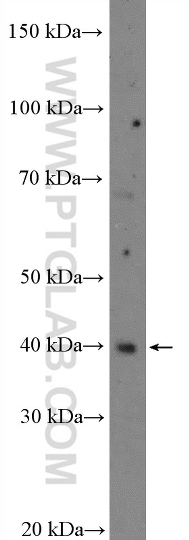 C10orf46 Antibody in Western Blot (WB)