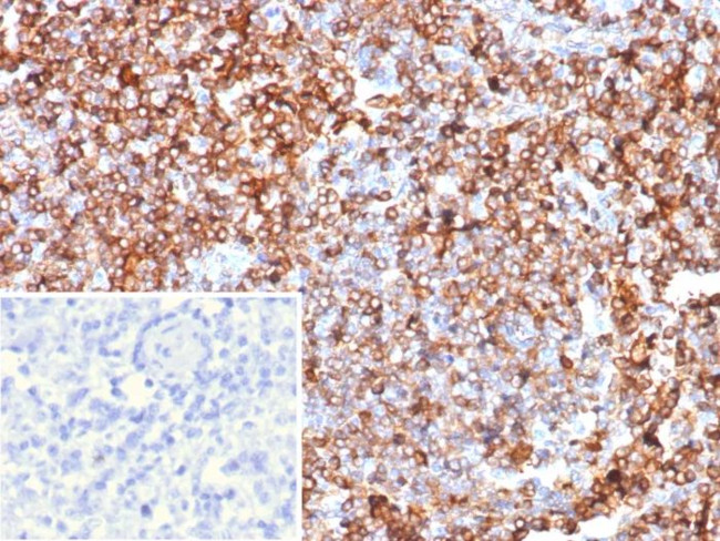 GBP1 Antibody in Immunohistochemistry (Paraffin) (IHC (P))