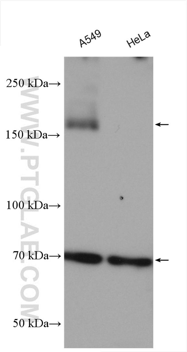 AE2 Antibody in Western Blot (WB)