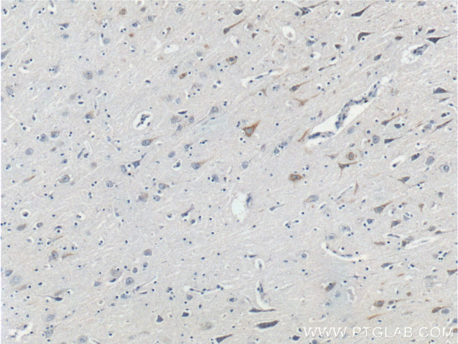 Neurofascin Antibody in Immunohistochemistry (Paraffin) (IHC (P))