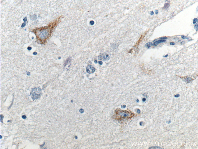 Neurofascin Antibody in Immunohistochemistry (Paraffin) (IHC (P))