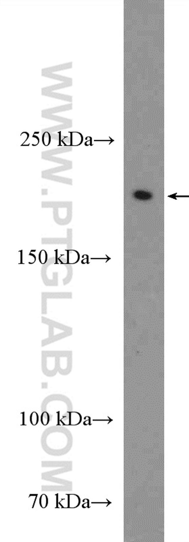 Neurofascin Antibody in Western Blot (WB)