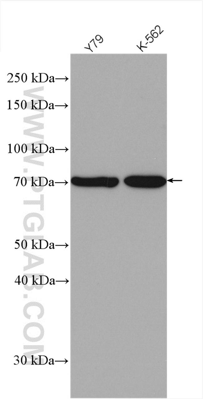 F2R Antibody in Western Blot (WB)