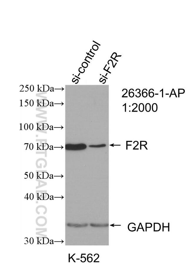 F2R Antibody in Western Blot (WB)