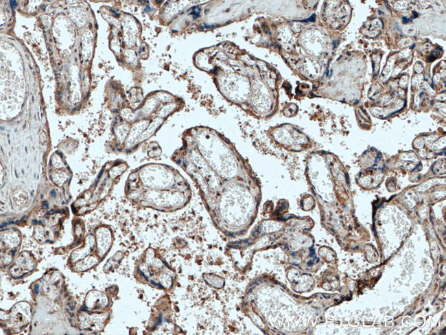 RBCK1 Antibody in Immunohistochemistry (Paraffin) (IHC (P))