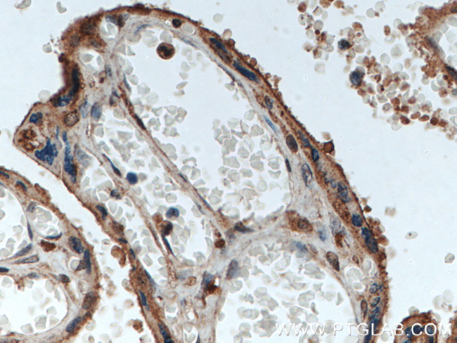 RBCK1 Antibody in Immunohistochemistry (Paraffin) (IHC (P))