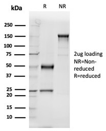 GC Vitamin D Binding Protein Antibody in SDS-PAGE (SDS-PAGE)