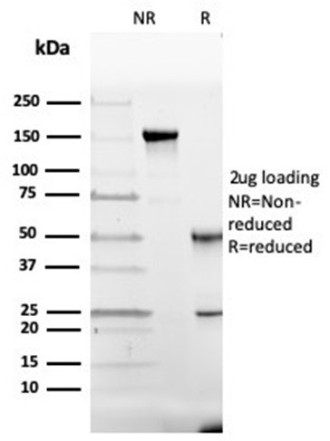 GC Vitamin D Binding Protein Antibody in SDS-PAGE (SDS-PAGE)