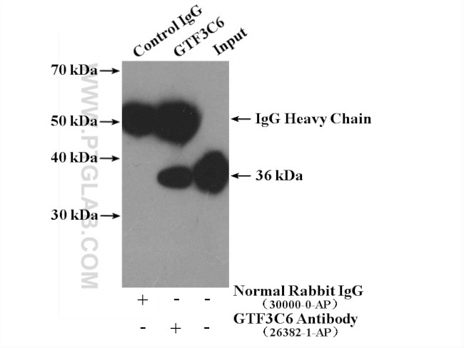 GTF3C6 Antibody in Immunoprecipitation (IP)