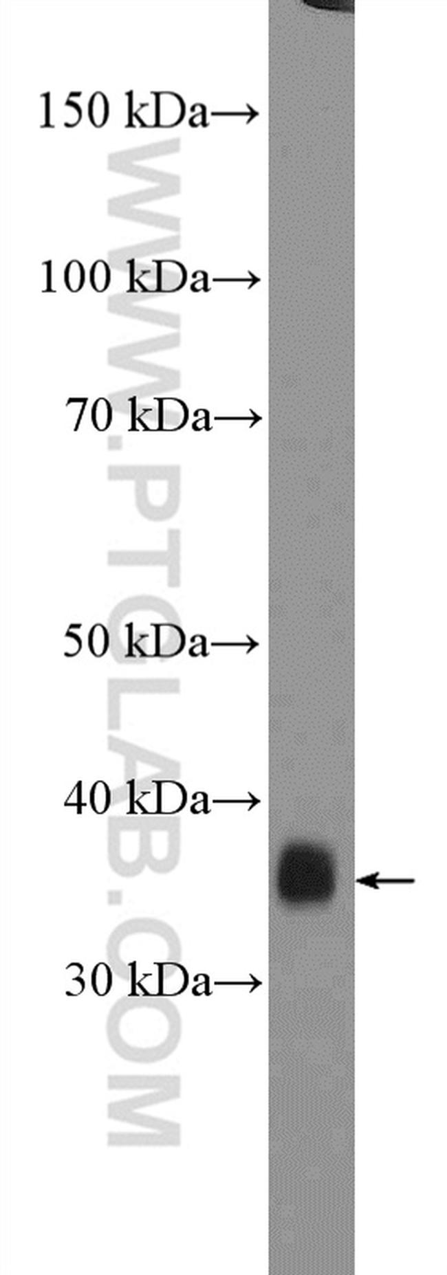 GTF3C6 Antibody in Western Blot (WB)