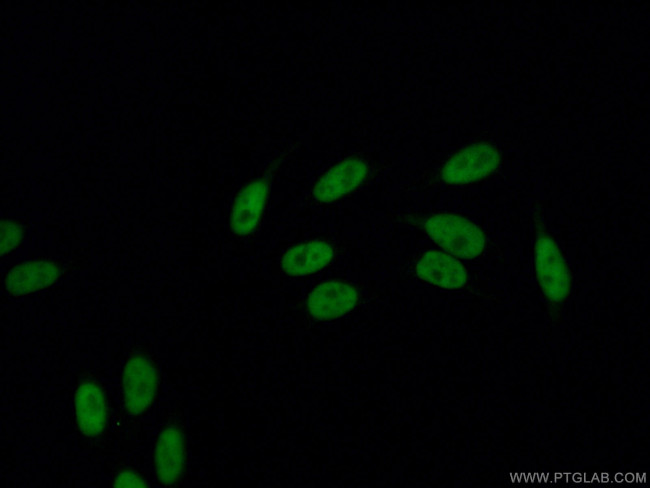 DDX5 Antibody in Immunocytochemistry (ICC/IF)