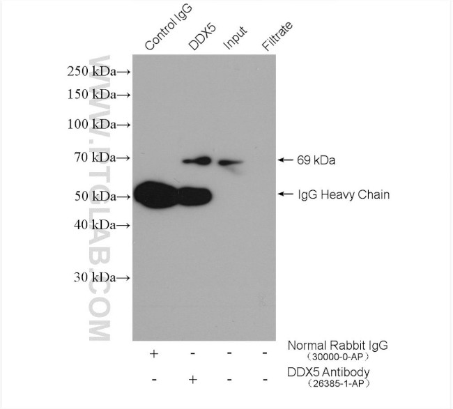 DDX5 Antibody in Immunoprecipitation (IP)