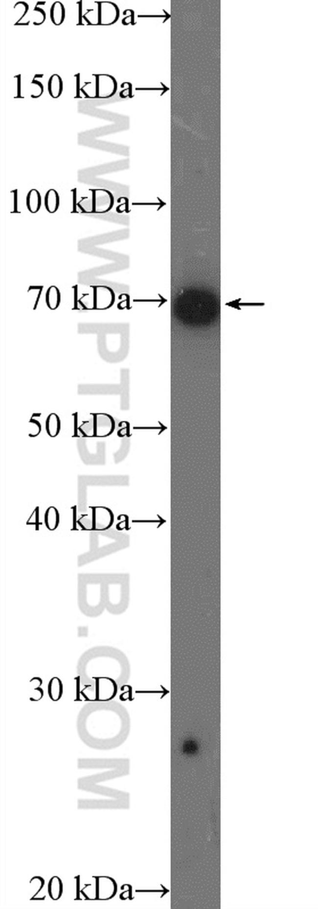 DDX5 Antibody in Western Blot (WB)