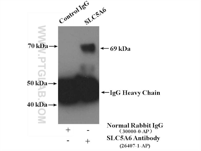 SLC5A6 Antibody in Immunoprecipitation (IP)