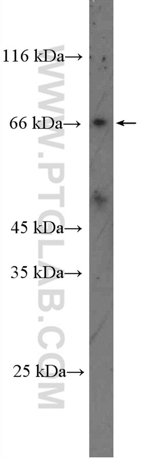 SLC5A6 Antibody in Western Blot (WB)