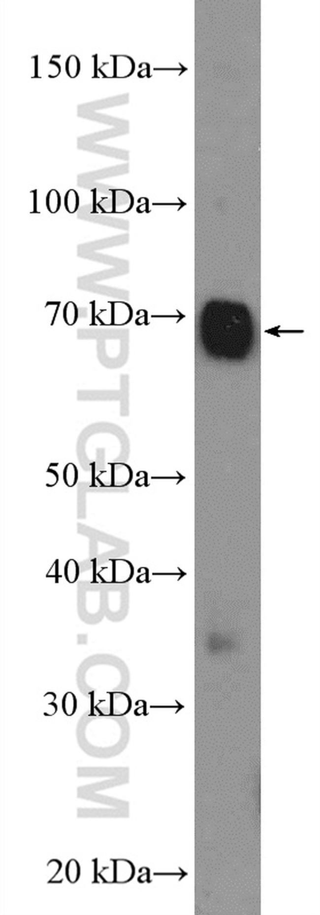 SLC5A6 Antibody in Western Blot (WB)