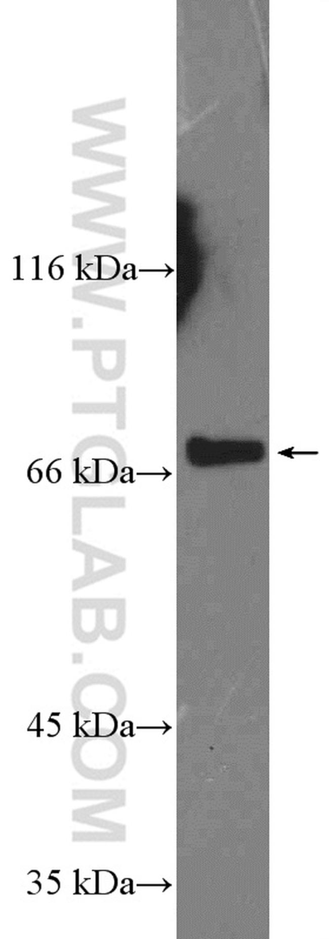 SLC5A6 Antibody in Western Blot (WB)