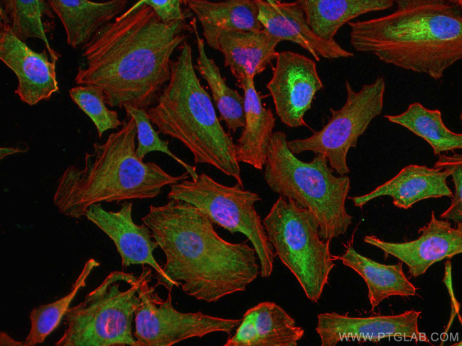 pan-keratin Antibody in Immunocytochemistry (ICC/IF)