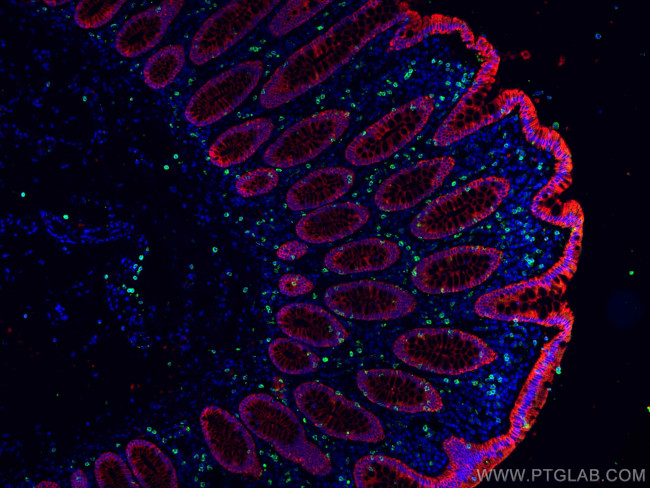 pan-keratin Antibody in Immunohistochemistry (PFA fixed) (IHC (PFA))