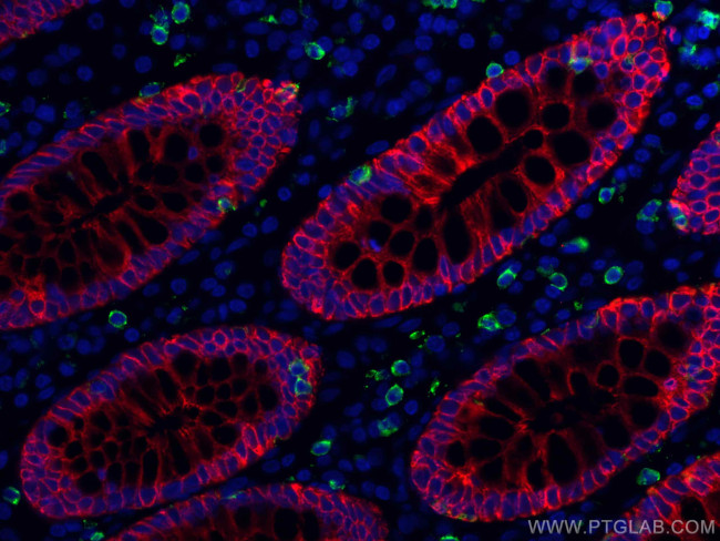 pan-keratin Antibody in Immunohistochemistry (PFA fixed) (IHC (PFA))