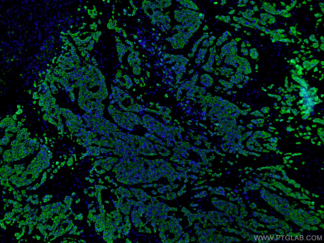 pan-keratin Antibody in Immunohistochemistry (PFA fixed) (IHC (PFA))