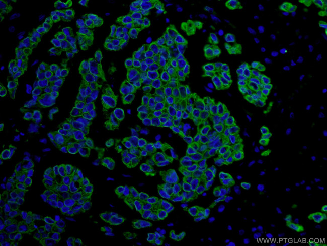 pan-keratin Antibody in Immunohistochemistry (PFA fixed) (IHC (PFA))