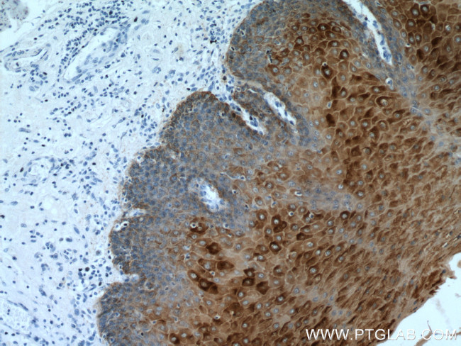 pan-keratin Antibody in Immunohistochemistry (Paraffin) (IHC (P))