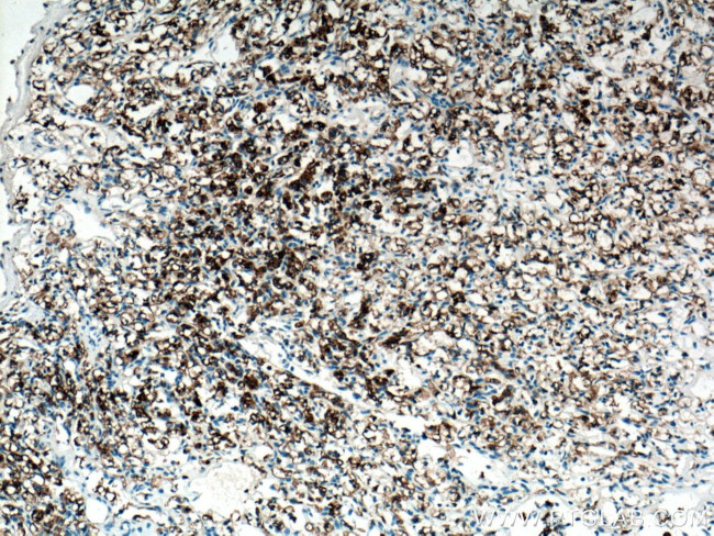 pan-keratin Antibody in Immunohistochemistry (Paraffin) (IHC (P))