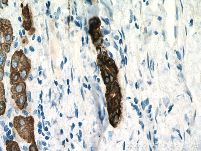 pan-keratin Antibody in Immunohistochemistry (Paraffin) (IHC (P))