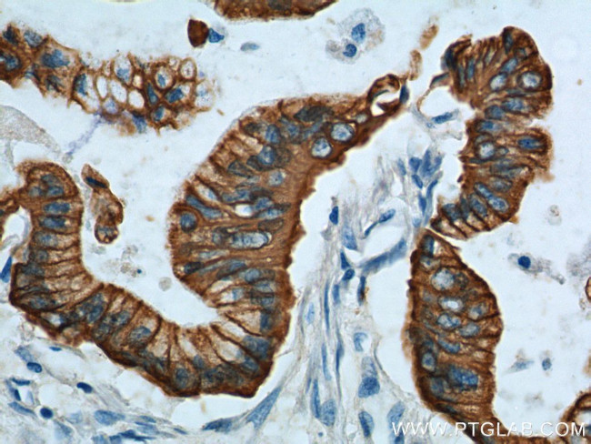 pan-keratin Antibody in Immunohistochemistry (Paraffin) (IHC (P))