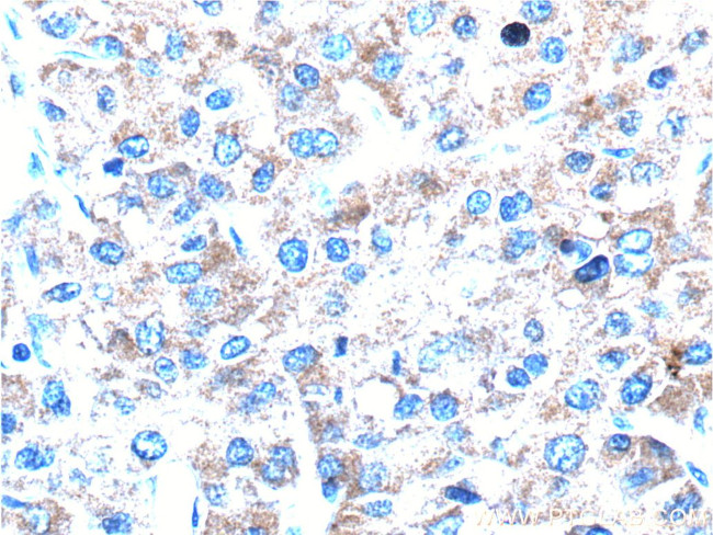 pan-keratin Antibody in Immunohistochemistry (Paraffin) (IHC (P))