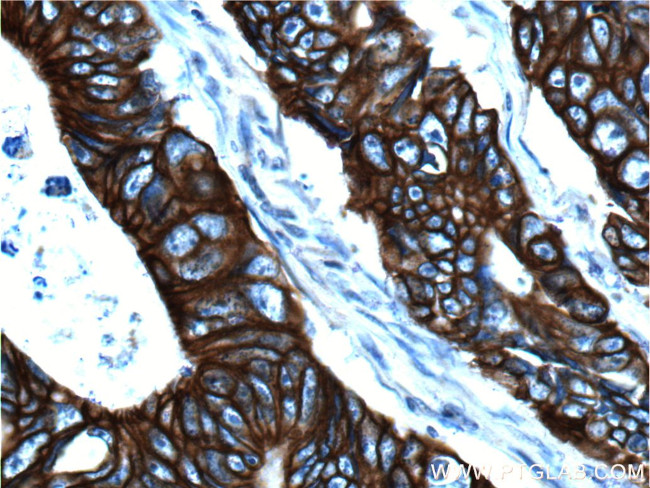 pan-keratin Antibody in Immunohistochemistry (Paraffin) (IHC (P))