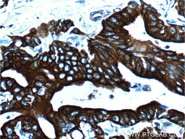 pan-keratin Antibody in Immunohistochemistry (Paraffin) (IHC (P))