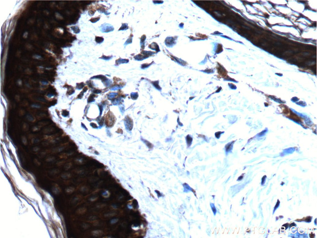 pan-keratin Antibody in Immunohistochemistry (Paraffin) (IHC (P))