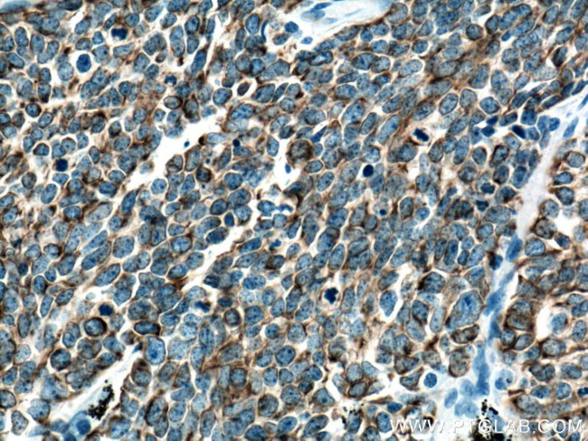 pan-keratin Antibody in Immunohistochemistry (Paraffin) (IHC (P))