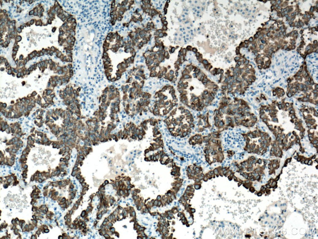 pan-keratin Antibody in Immunohistochemistry (Paraffin) (IHC (P))