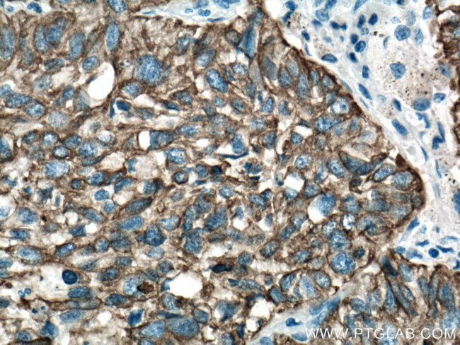 pan-keratin Antibody in Immunohistochemistry (Paraffin) (IHC (P))