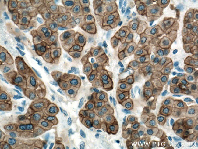 pan-keratin Antibody in Immunohistochemistry (Paraffin) (IHC (P))