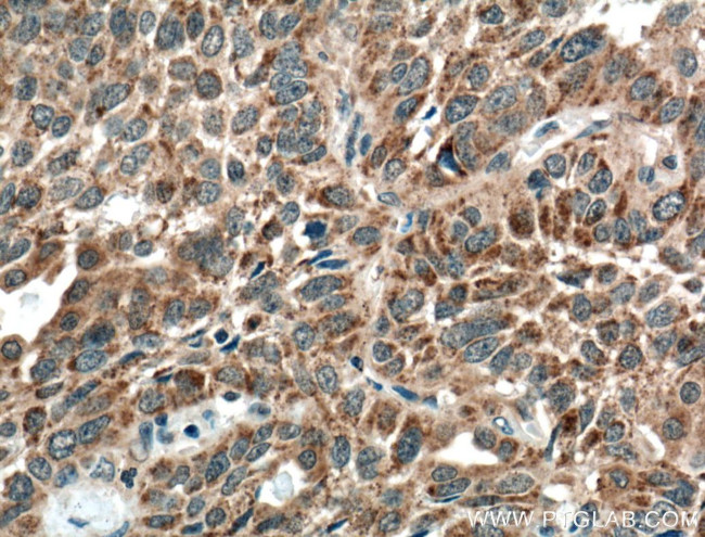 VEGF Receptor 2 Antibody in Immunohistochemistry (Paraffin) (IHC (P))