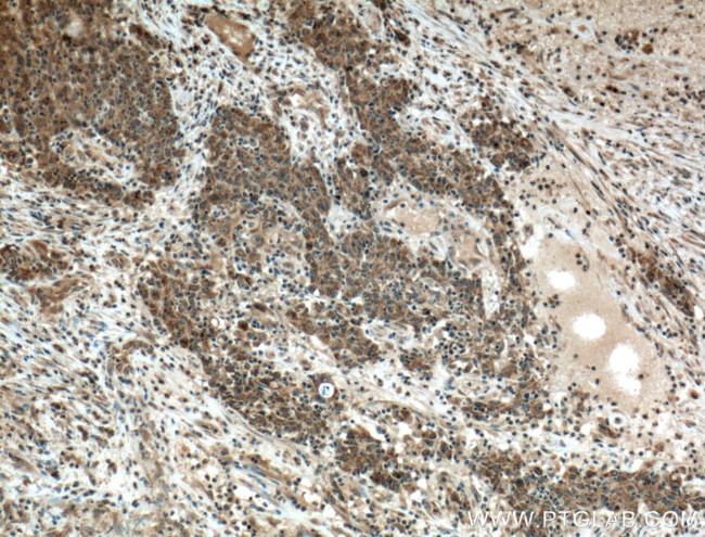 VEGF Receptor 2 Antibody in Immunohistochemistry (Paraffin) (IHC (P))