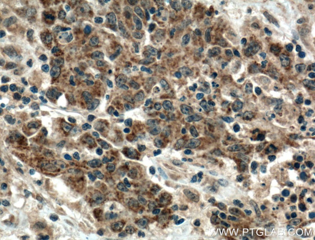 VEGF Receptor 2 Antibody in Immunohistochemistry (Paraffin) (IHC (P))