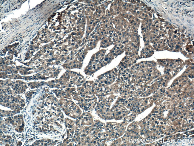 VEGF Receptor 2 Antibody in Immunohistochemistry (Paraffin) (IHC (P))