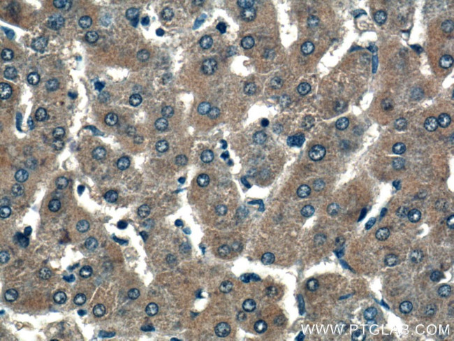 VEGF Receptor 2 Antibody in Immunohistochemistry (Paraffin) (IHC (P))